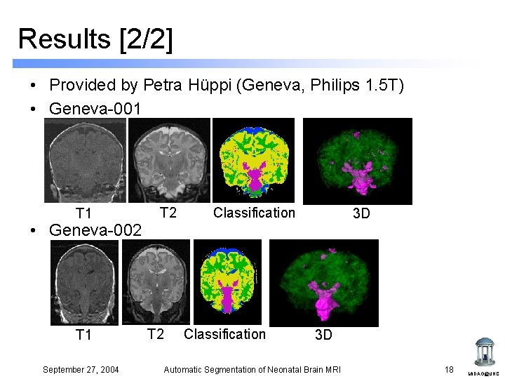 Results [2/2] • Provided by Petra Hüppi (Geneva, Philips 1. 5 T) • Geneva-001