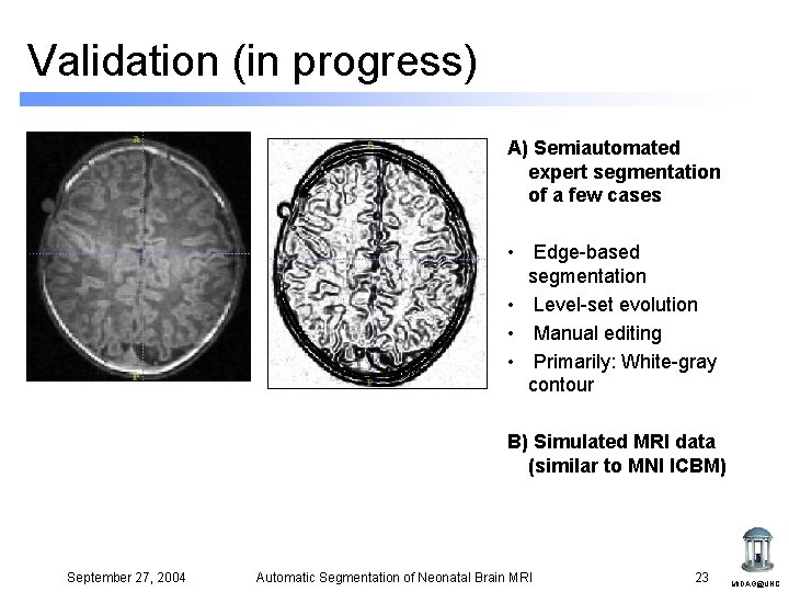 Validation (in progress) A) Semiautomated expert segmentation of a few cases • Edge-based segmentation Validation (in progress) A) Semiautomated expert segmentation of a few cases • Edge-based segmentation