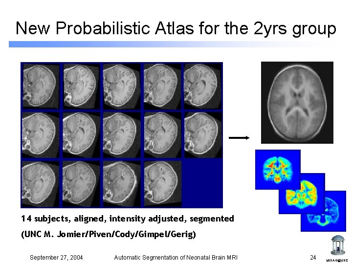 New Probabilistic Atlas for the 2 yrs group 14 subjects, aligned, intensity adjusted, segmented New Probabilistic Atlas for the 2 yrs group 14 subjects, aligned, intensity adjusted, segmented