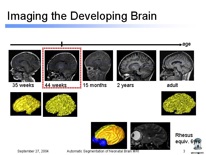Imaging the Developing Brain age 35 weeks 44 weeks 15 months 2 years adult Imaging the Developing Brain age 35 weeks 44 weeks 15 months 2 years adult