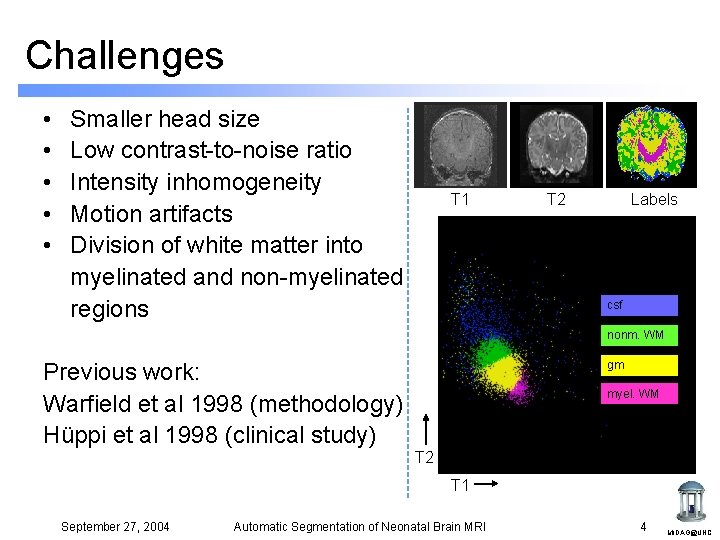 Challenges • • • Smaller head size Low contrast-to-noise ratio Intensity inhomogeneity Motion artifacts Challenges • • • Smaller head size Low contrast-to-noise ratio Intensity inhomogeneity Motion artifacts