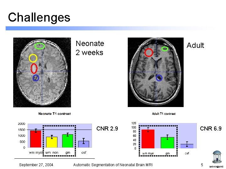 Challenges Neonate 2 weeks CNR 2. 9 September 27, 2004 Automatic Segmentation of Neonatal Challenges Neonate 2 weeks CNR 2. 9 September 27, 2004 Automatic Segmentation of Neonatal