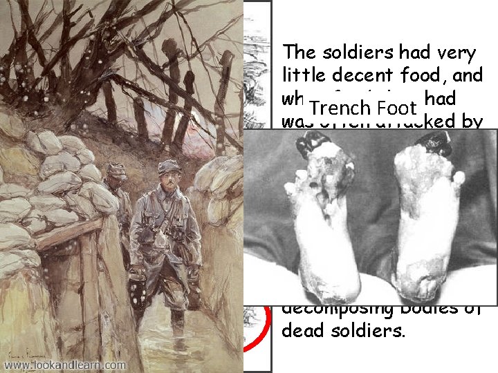 The soldiers had very little decent food, and what food they had Trench Foot
