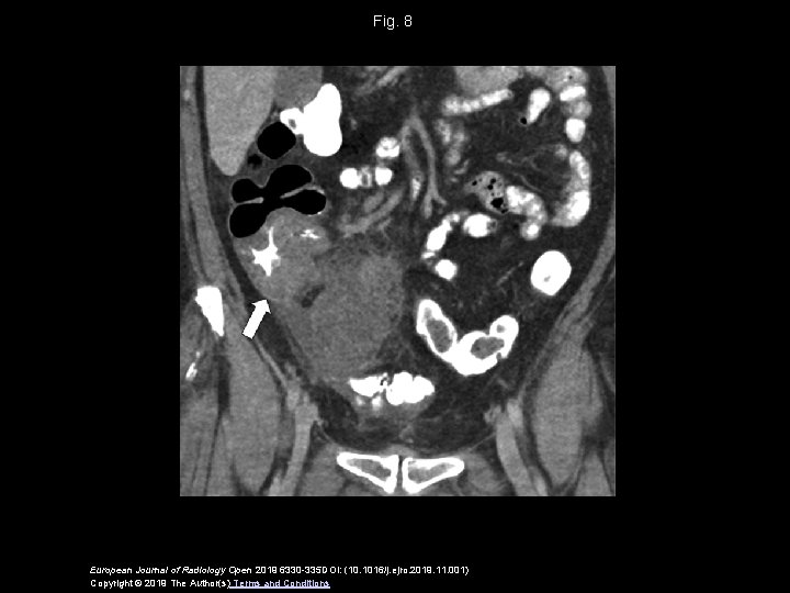 Reliability of standardized reporting system of acute appendicitis