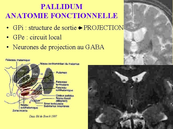 PALLIDUM ANATOMIE FONCTIONNELLE • GPi : structure de sortie PROJECTION • GPe : circuit