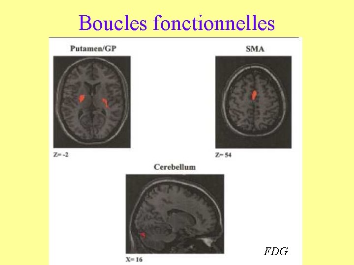 Boucles fonctionnelles FDG 