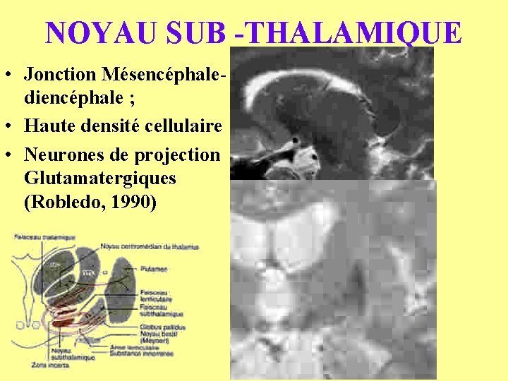 NOYAU SUB -THALAMIQUE • Jonction Mésencéphalediencéphale ; • Haute densité cellulaire • Neurones de