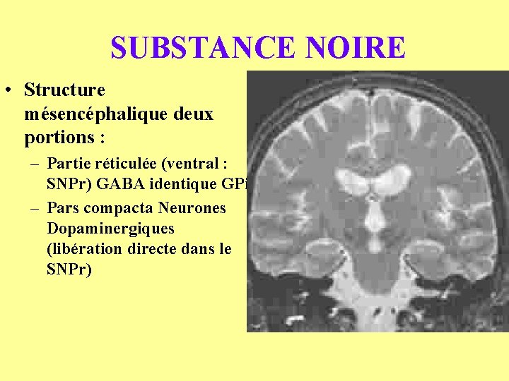 SUBSTANCE NOIRE • Structure mésencéphalique deux portions : – Partie réticulée (ventral : SNPr)