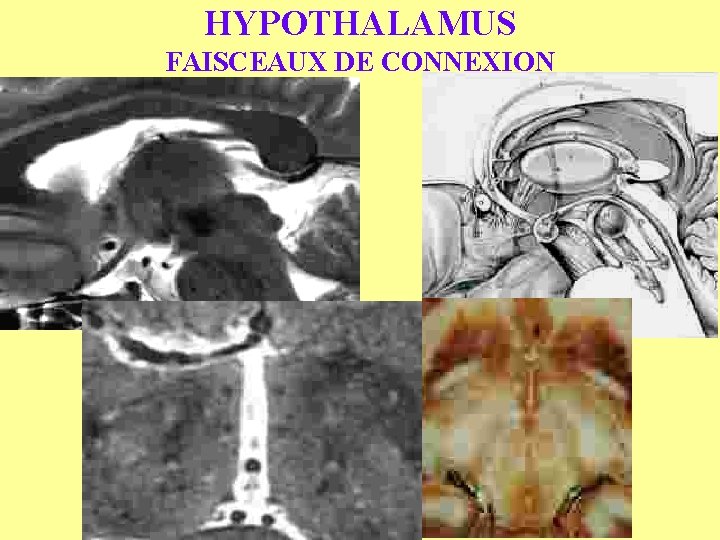 HYPOTHALAMUS FAISCEAUX DE CONNEXION 