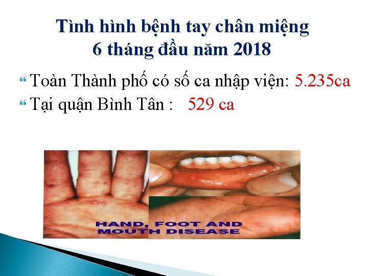 Tình hình bệnh tay chân miệng 6 tháng đầu năm 2018 Toàn Thành phố