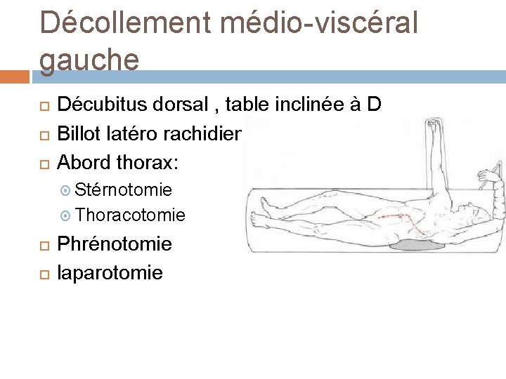 Décollement médio-viscéral gauche Décubitus dorsal , table inclinée à D Billot latéro rachidien Abord