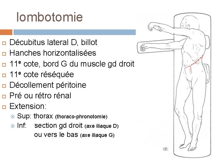 lombotomie Décubitus lateral D, billot Hanches horizontalisées 11 e cote, bord G du muscle