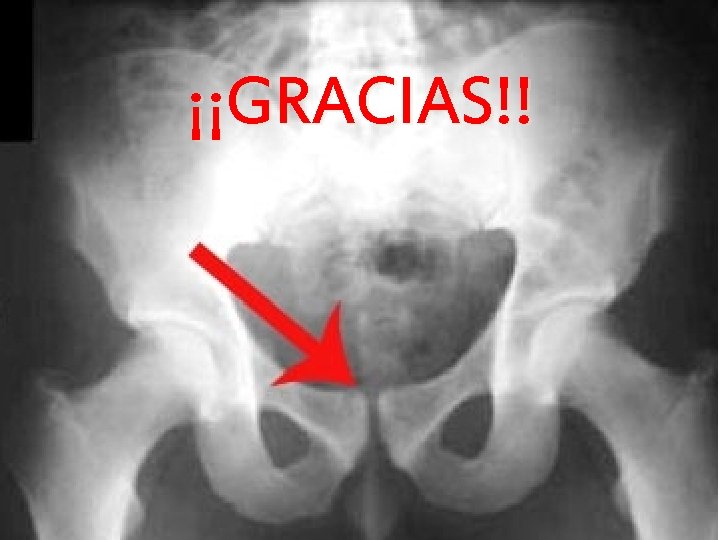 ¡¡GRACIAS!! 