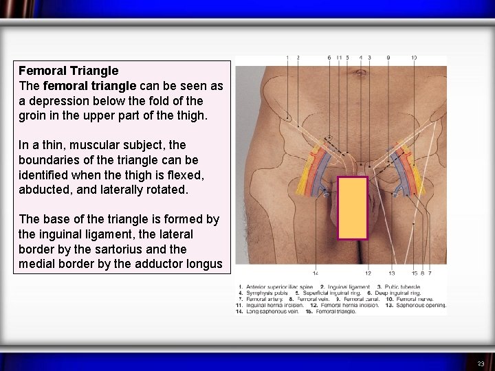 Femoral Triangle The femoral triangle can be seen as a depression below the fold