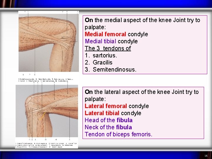 On the medial aspect of the knee Joint try to palpate: Medial femoral condyle