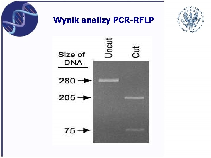 Wynik analizy PCR-RFLP 