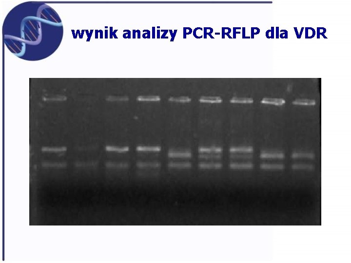 wynik analizy PCR-RFLP dla VDR 