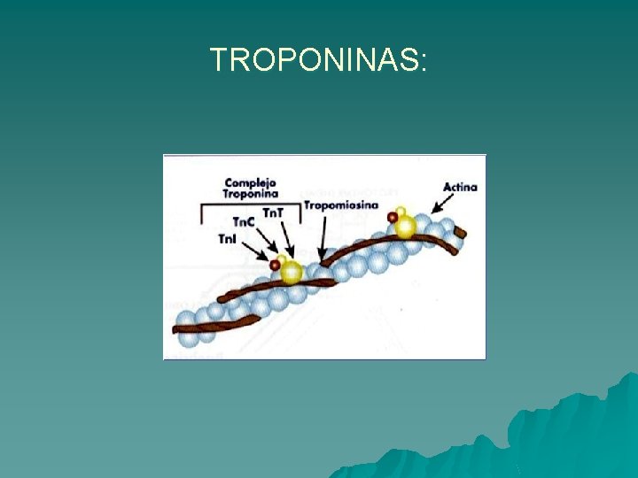 TROPONINAS: 