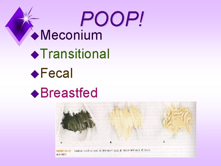 POOP! u. Meconium u. Transitional u. Fecal u. Breastfed 