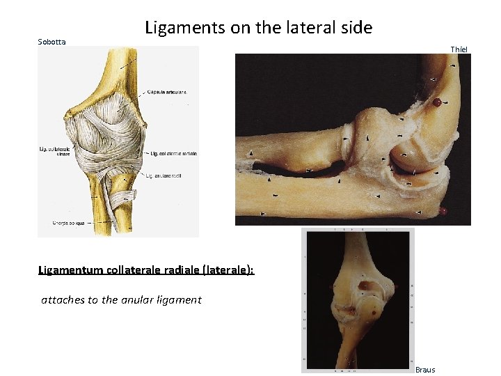 Sobotta Ligaments on the lateral side Thiel Ligamentum collaterale radiale (laterale): attaches to the