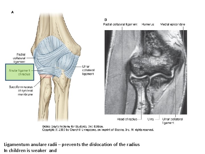 Ligamentum anulare radii – prevents the dislocation of the radius In children is weaker