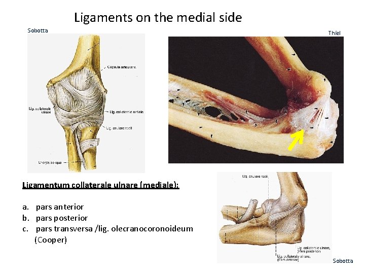 Ligaments on the medial side Sobotta Thiel Ligamentum collaterale ulnare (mediale): a. pars anterior
