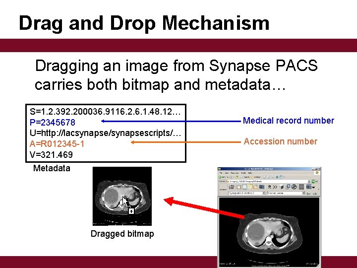 Drag and Drop Mechanism Dragging an image from Synapse PACS carries both bitmap and