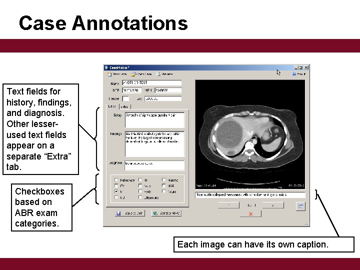 Case Annotations Text fields for history, findings, and diagnosis. Other lesserused text fields appear