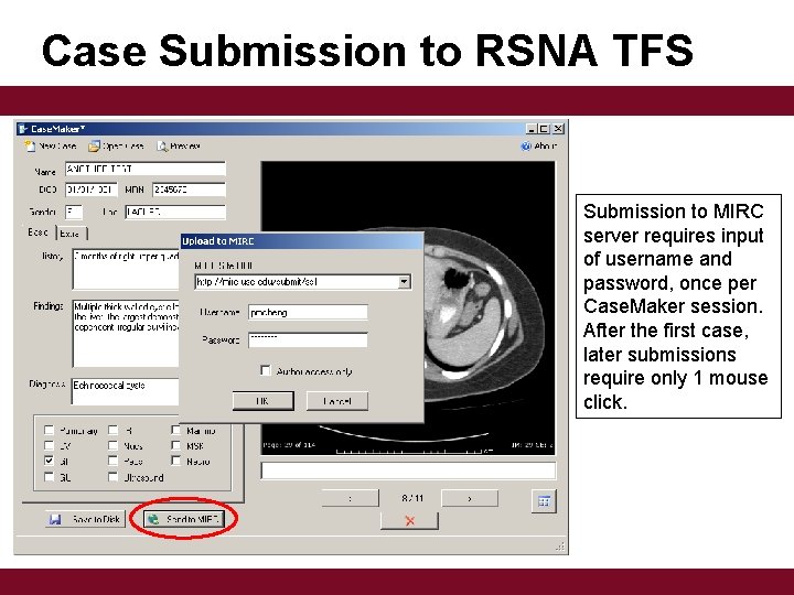 Case Submission to RSNA TFS Submission to MIRC server requires input of username and