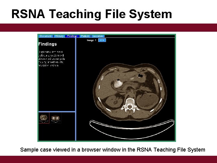 RSNA Teaching File System Sample case viewed in a browser window in the RSNA