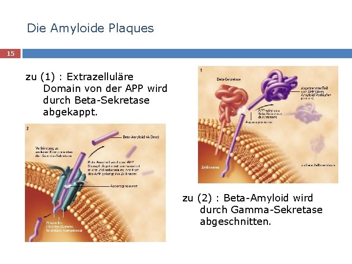 Die Amyloide Plaques 15 zu (1) : Extrazelluläre Domain von der APP wird durch