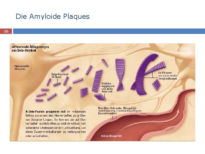 Die Amyloide Plaques 16 