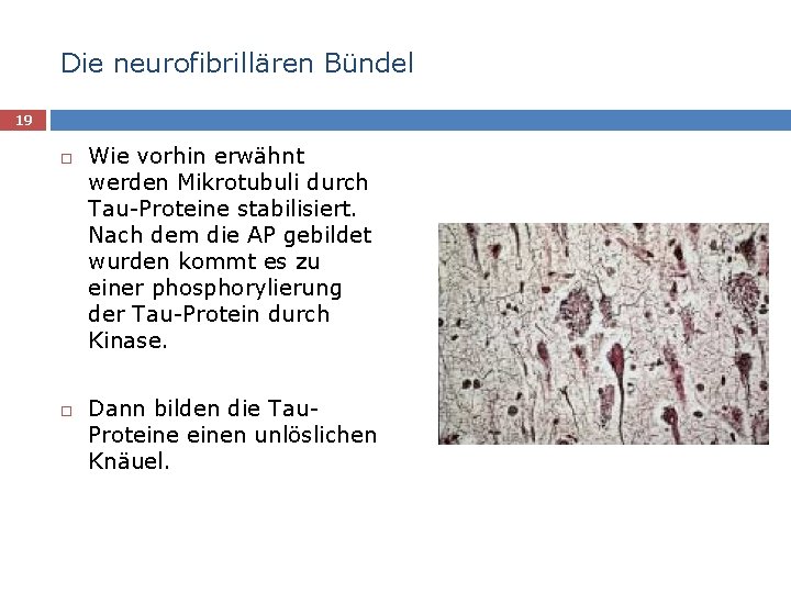 Die neurofibrillären Bündel 19 Wie vorhin erwähnt werden Mikrotubuli durch Tau-Proteine stabilisiert. Nach dem