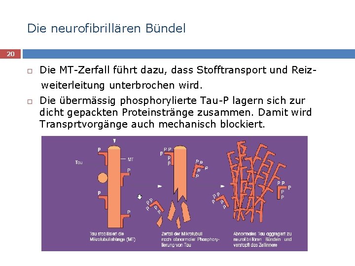 Die neurofibrillären Bündel 20 Die MT-Zerfall führt dazu, dass Stofftransport und Reizweiterleitung unterbrochen wird.