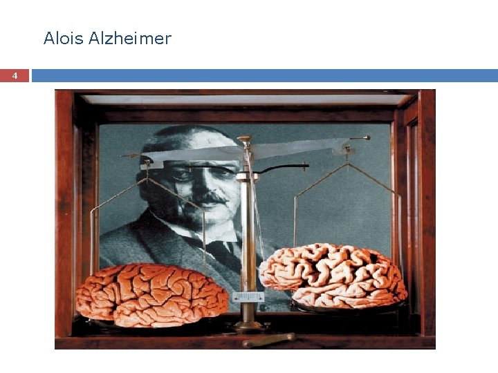 Alois Alzheimer 4 