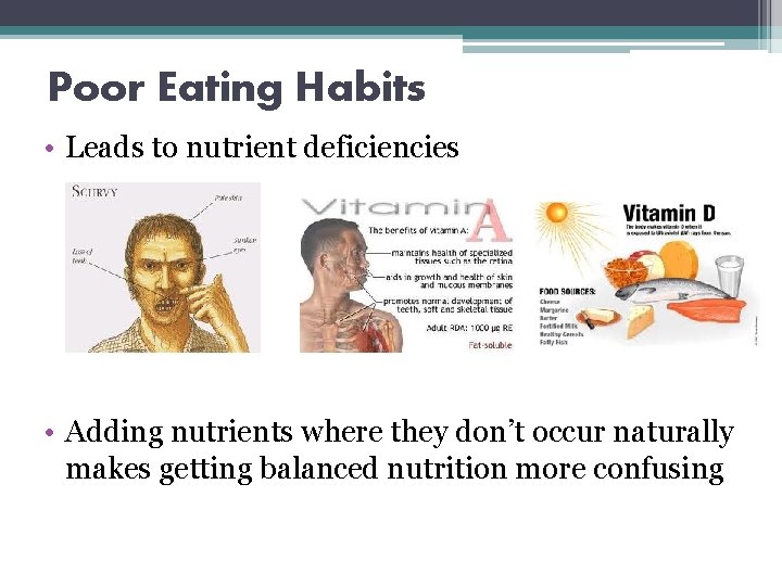 Poor Eating Habits • Leads to nutrient deficiencies • Adding nutrients where they don’t