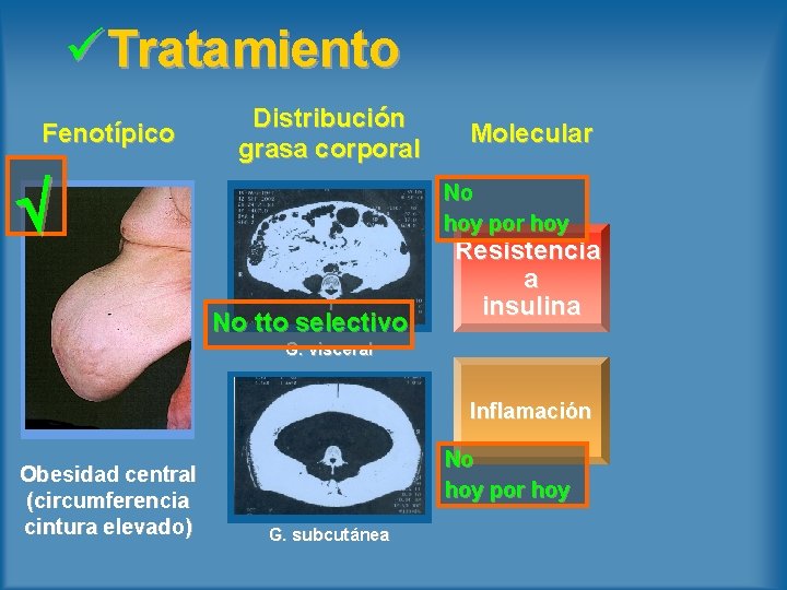 üTratamiento Fenotípico Distribución grasa corporal Molecular No hoy por hoy No tto selectivo Resistencia