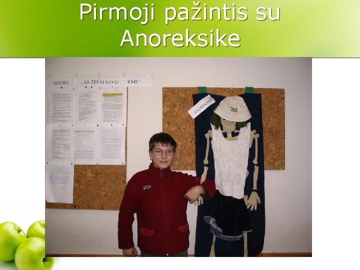 Pirmoji pažintis su Anoreksike 