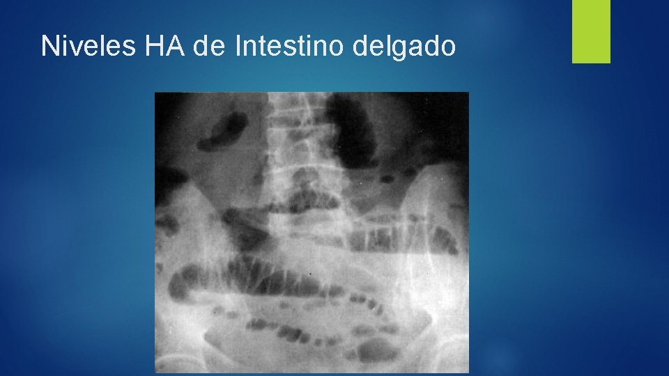 Niveles HA de Intestino delgado 