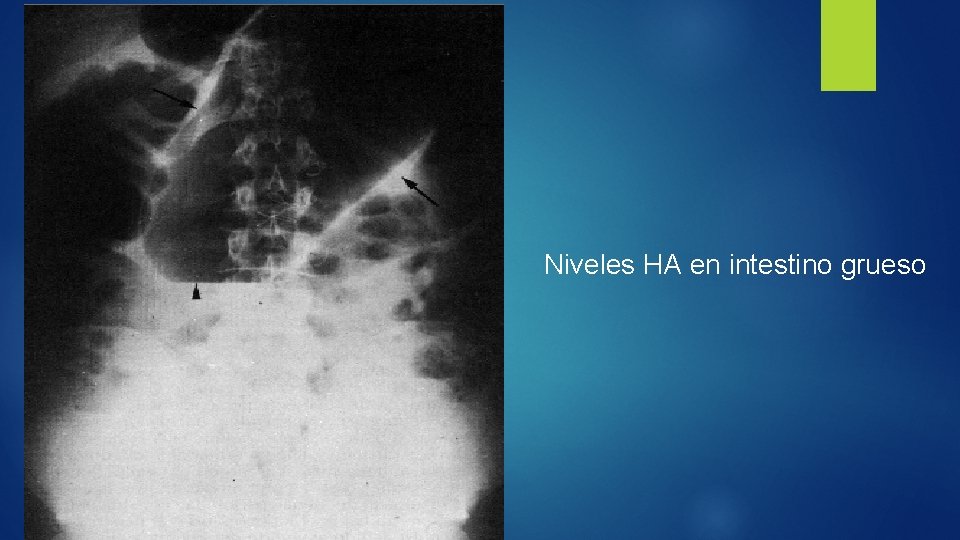 Niveles HA en intestino grueso 