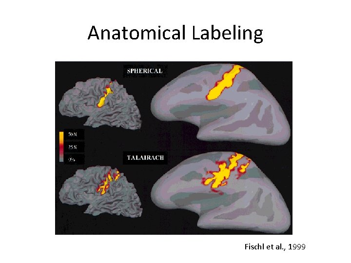 Anatomical Labeling Fischl et al. , 1999 