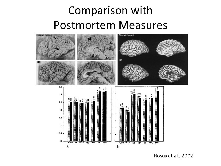 Comparison with Postmortem Measures Rosas et al. , 2002 