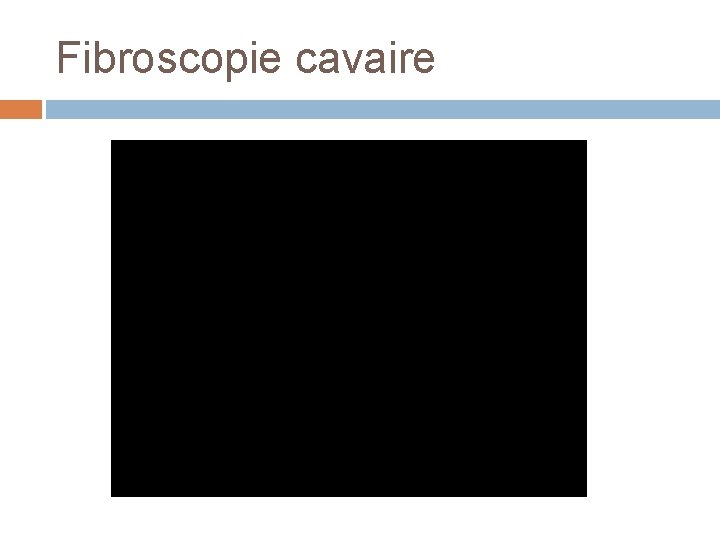 Fibroscopie cavaire 