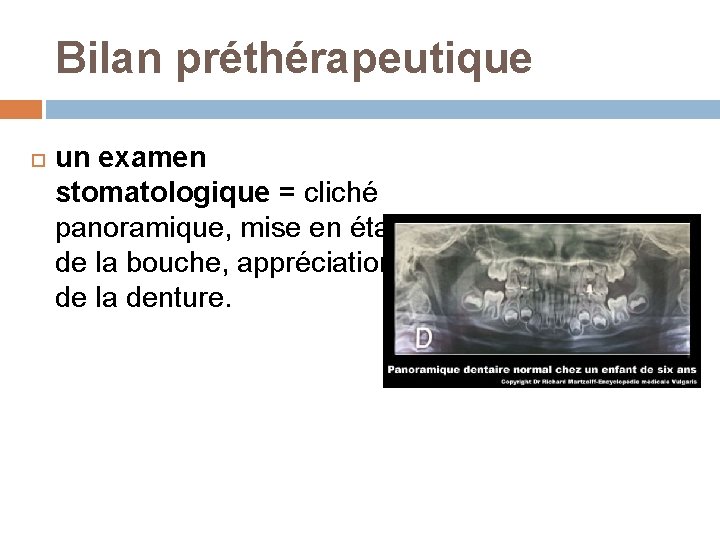 Bilan préthérapeutique un examen stomatologique = cliché panoramique, mise en état de la bouche,