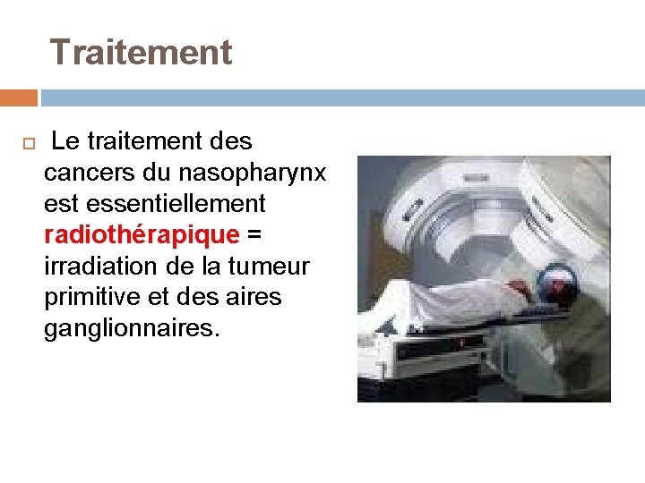  Traitement Le traitement des cancers du nasopharynx est essentiellement radiothérapique = irradiation de