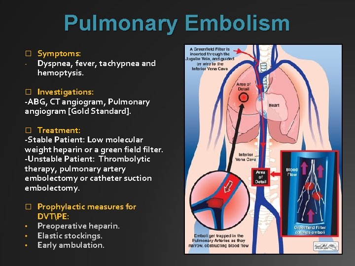 Pulmonary Embolism � - Symptoms: Dyspnea, fever, tachypnea and hemoptysis. Investigations: -ABG, CT angiogram,