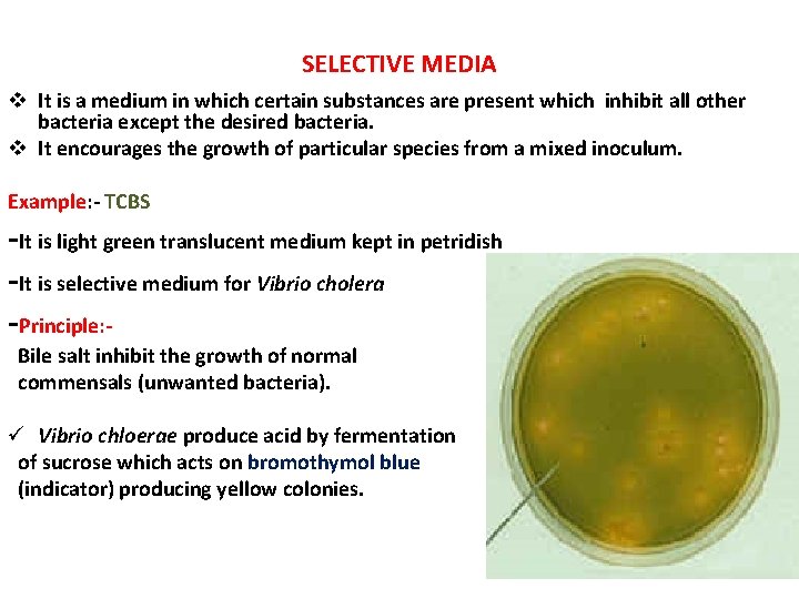 SELECTIVE MEDIA v It is a medium in which certain substances are present which