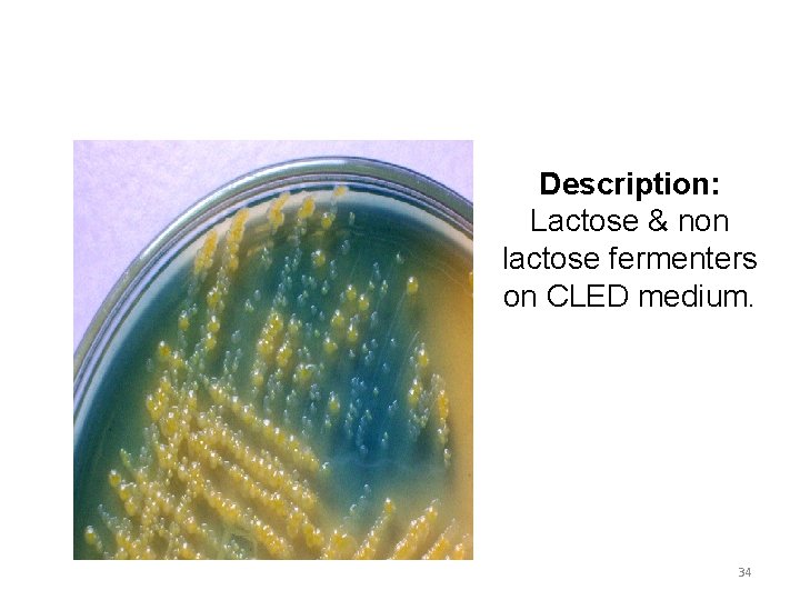 Description: Lactose & non lactose fermenters on CLED medium. 34 
