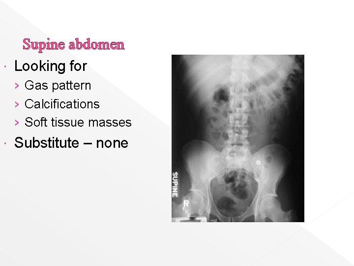  Supine abdomen Looking for › Gas pattern › Calcifications › Soft tissue masses