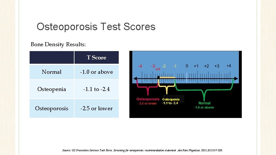 Osteoporosis Test Scores Bone Density Results: T Score Normal -1. 0 or above Osteopenia